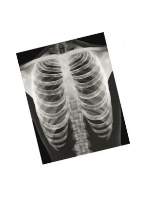 Conjunto de Radiografias de Ossos Humanos - 18 peças