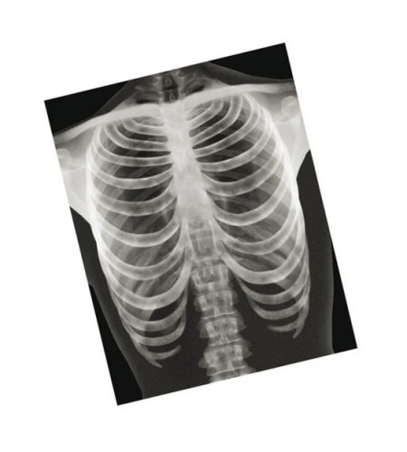 Conjunto de Radiografias de Ossos Humanos - 18 peças
