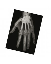 Conjunto de Radiografias de Ossos Humanos - 18 peças