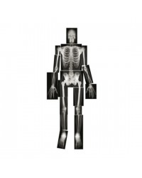 Conjunto de Radiografias de Ossos Humanos - 18 peças