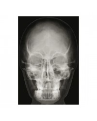 Conjunto de Radiografias de Ossos Humanos - 18 peças